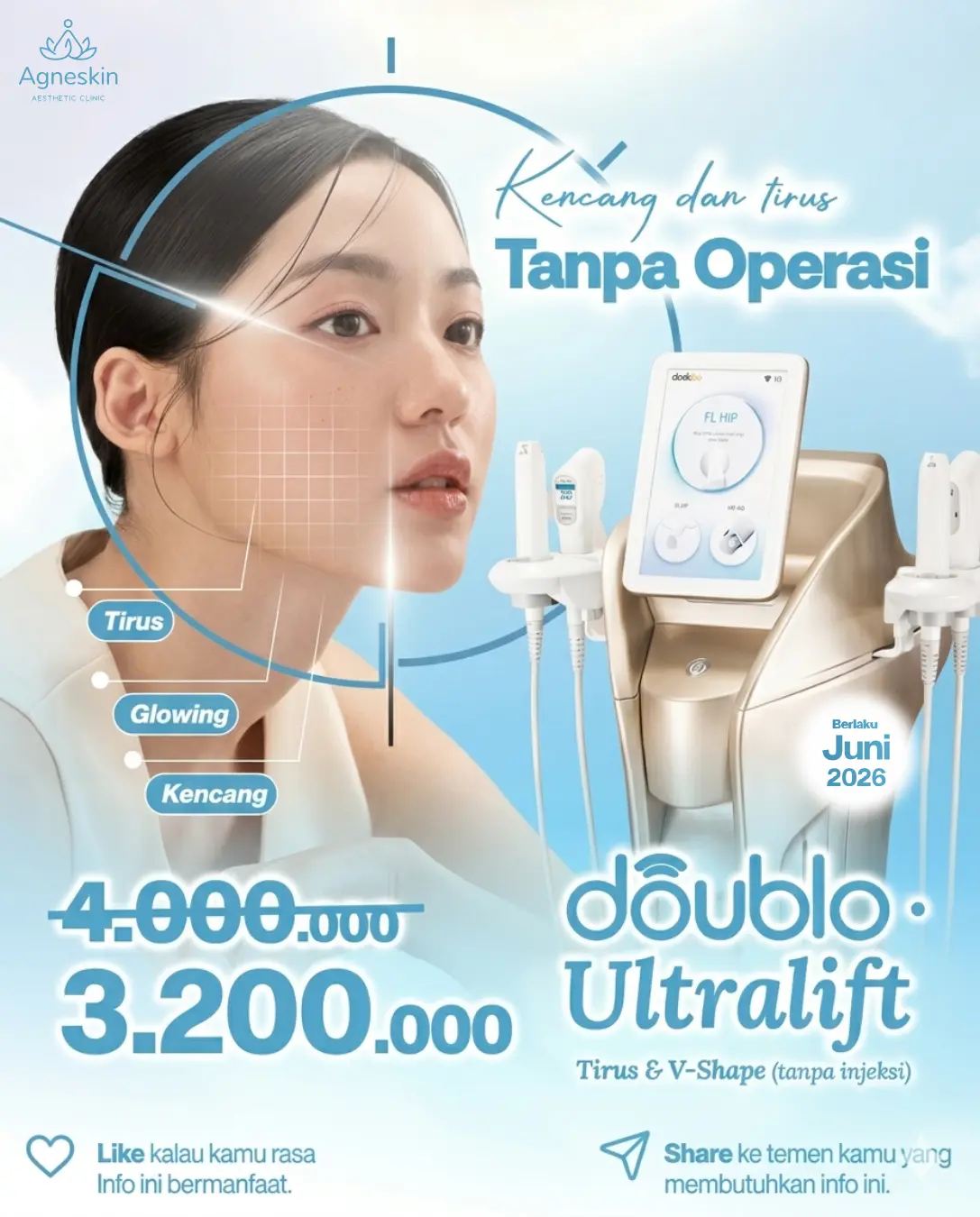 Promo Doublo Ultralift Juni 2026
